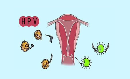 19岁女孩查出宫颈癌前病变，与这种病毒有关！ 75%的女性一生中都可能会感染