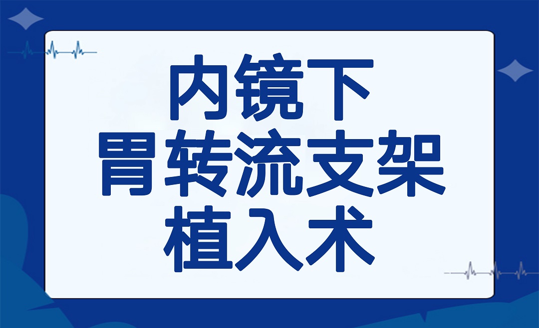 减重新风口——内镜下胃转流支架植入术
