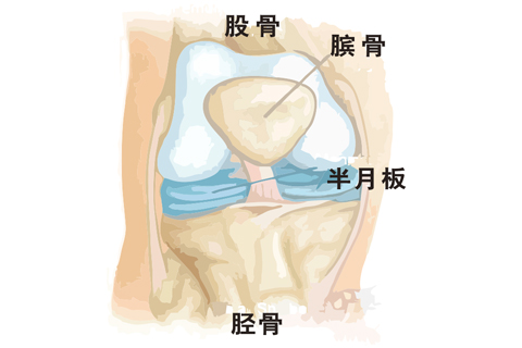 膝关节半月板损伤